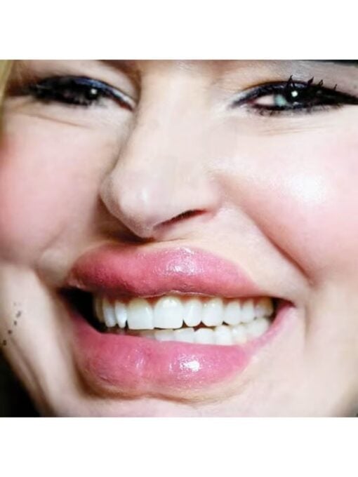 Botoxic Lips 3D Fx Transfer