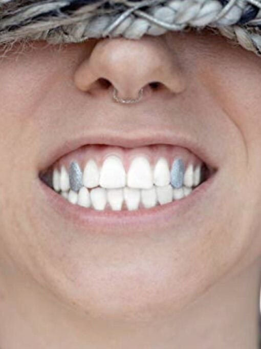 silver tooth paint
