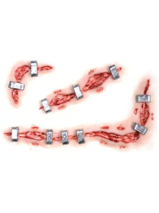 Staplestein 3D Transfer